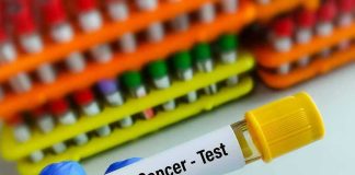 Gloved hand holding colon cancer test tube