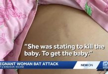 Pregnant woman attacked with bat while leaving work in