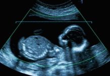 24-Week Abortion Limit Scrapped — Doctor Decides Fetal ultrasound scan image