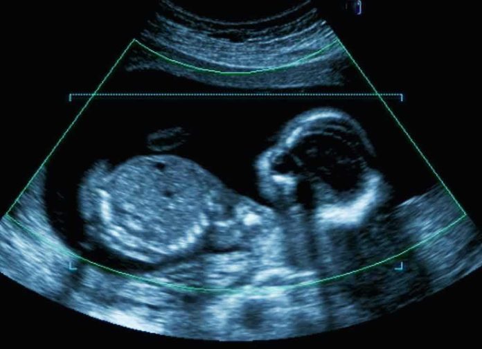 shutterstock_1008743368 Fetal ultrasound scan image
